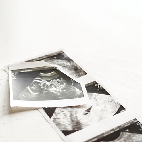 echographie obstetricale paris echographiste obstetrical centre sevres babylone paris cesb