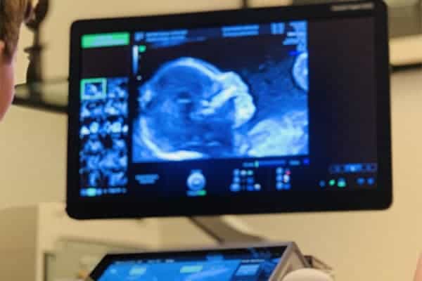 ecran echo 9 semaines de grossesse echographie 3em trimestre echographiste obstetrical centre echographie sevres babylone paris cesb